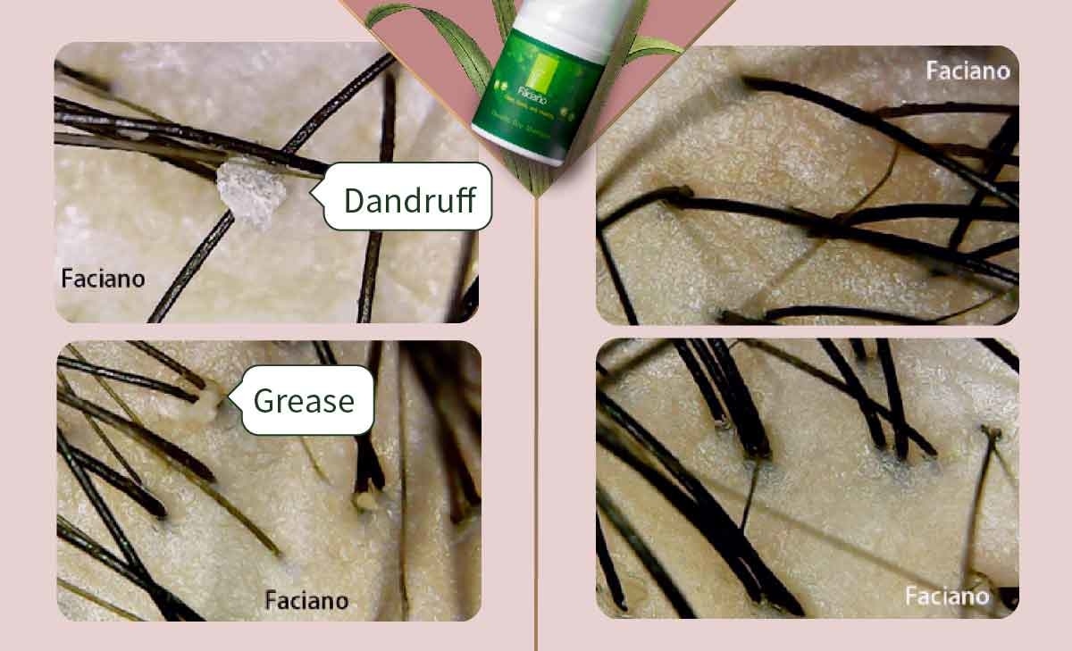 Before After Dry Shampoo