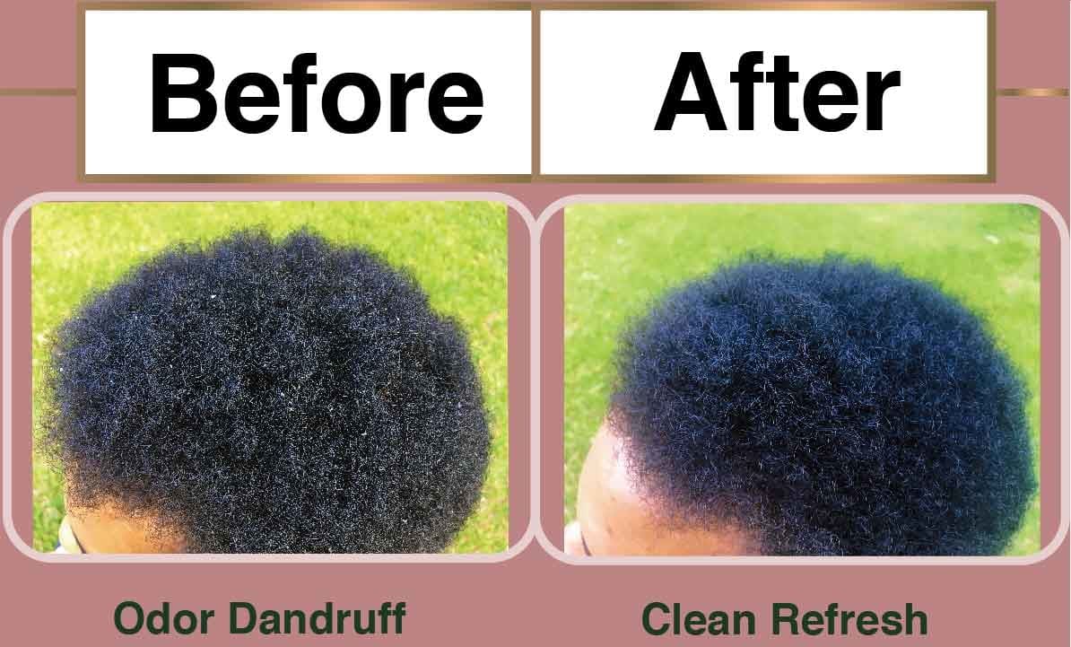 Before After Dry Shampoo